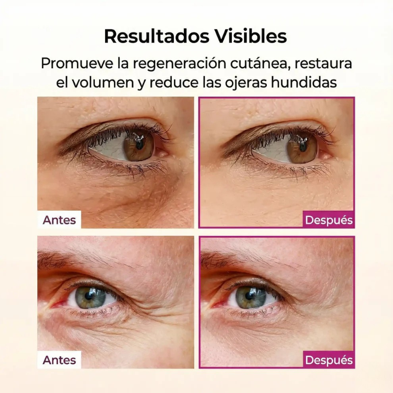 Bálsamo Facial Reafirmante - Elimina Arugas y Líneas de Expresión
