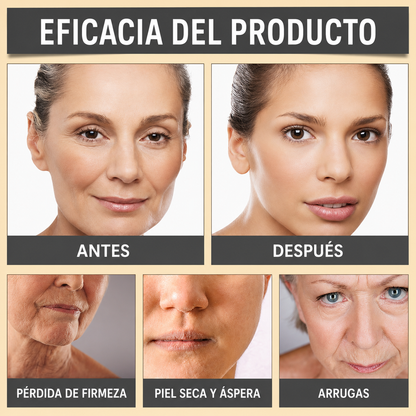 Lifting Bee Venom Crema antiarrugas