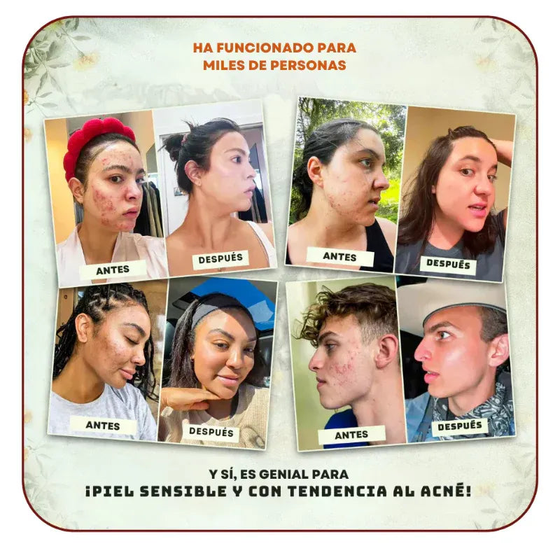 Bálsamo de Cebo de Res