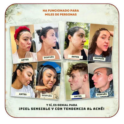 Bálsamo de Cebo de Res