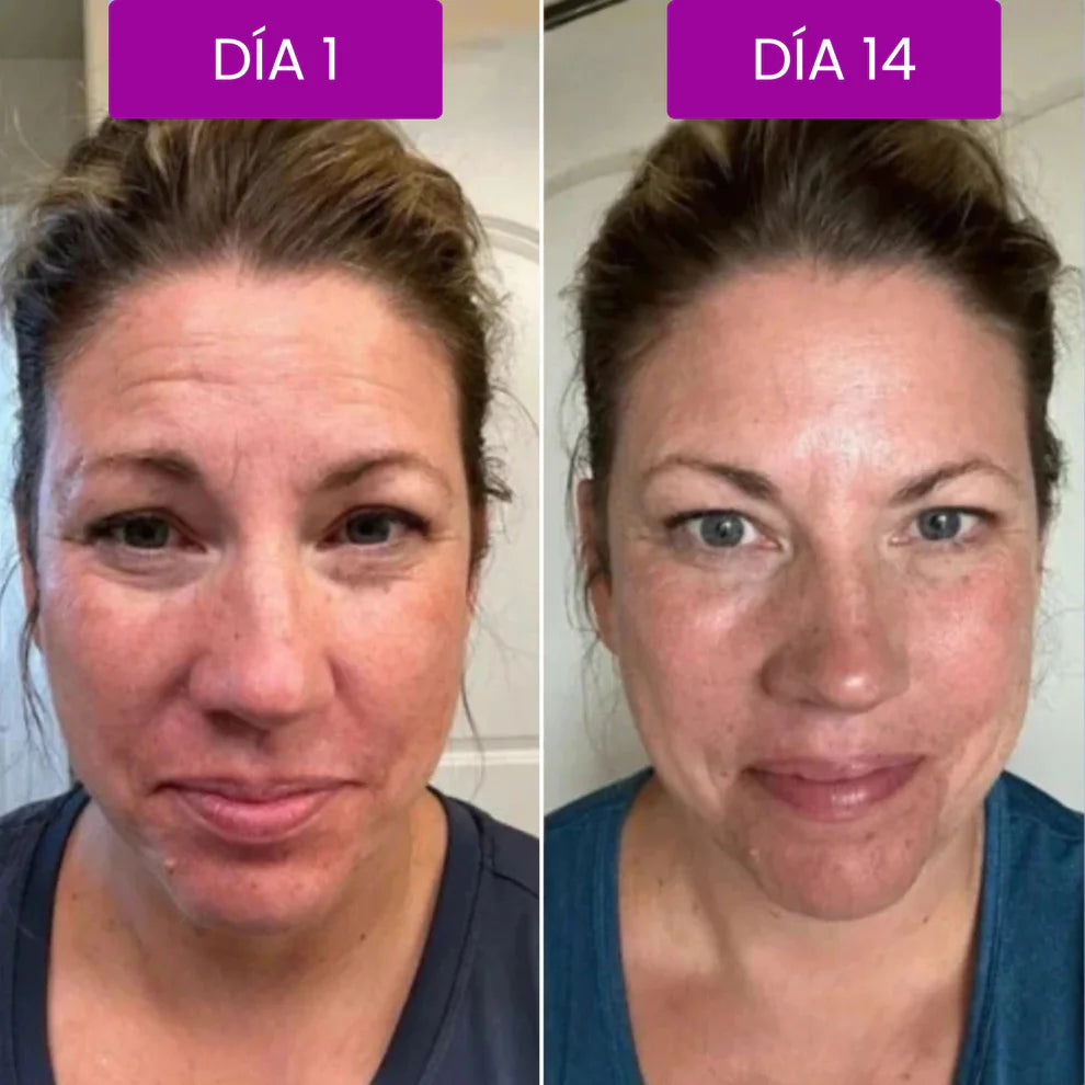 Bálsamo Facial Reafirmante - Elimina Arugas y Líneas de Expresión